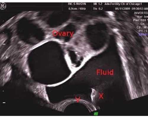 重庆助孕指南：权威供卵试管婴儿医院排名、成功率与费用深度解析