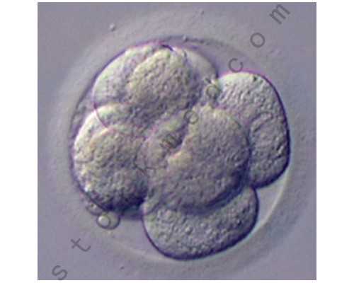 重庆地区试管婴儿：医院排名、费用详情及成功率解读