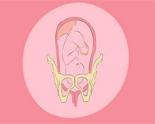 武汉代孕法律允许吗,远离产后身材走样、漏尿，